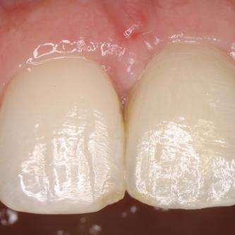 Exemple 1: résultat final.