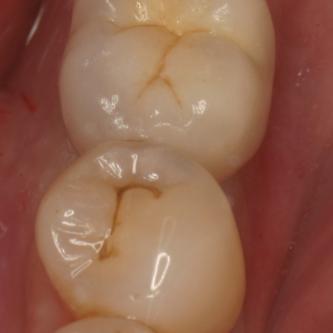 Exemple 7: vue depuis dessus